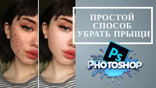 БЫСТРЫЙ и ЛЕГКИЙ способ убрать прыщи в фотошоп  | [2020]