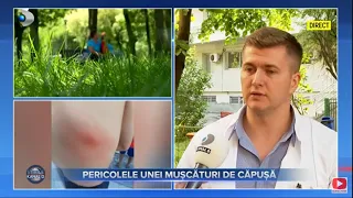 Stirile Kanal D (29.05.2023) - Pericolele unei muscaturi de capusa | Editie de dimineata