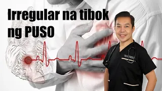 Atrial fibrillation o irregular na heartbeat