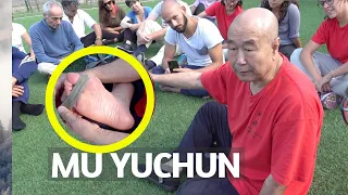 The bone on the leg will immediately stop hurting. Hallux valgus. Mu Yuchun.