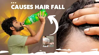 4 Reasons ( HAIRFALL 💇)( HAIR RECEDING) GARY HAIR) 🧔 ( I got you Solution 🌟) # trending #hairfall