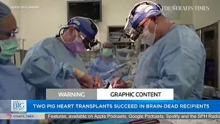 Two pig heart transplants succeed in brain-dead recipients