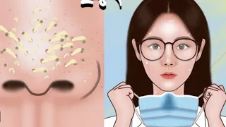 ASMR Face blackheads removal Treatment At Home || Deep Cleaning Satisfying & Relaxing Animation