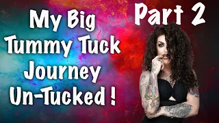 My Tummy Tuck Journey part 2