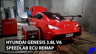 Hyundai Genesis SpeedLab ECU Remap
