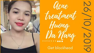 (Sub) Get blackhead | 26/10/2019 | Acne treatment Hương Đà Nẵng