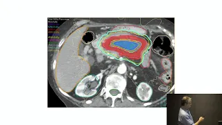 Radiation Oncology Update- New Techniques & Ideas 2/5/20