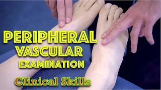 Peripheral Vascular Examination - Clinical Skills - Dr Gill