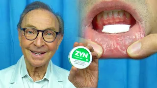 ZYN - Oral Health Risks and Benefits! Reviewed by Dr. Nemeth