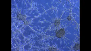 Exosome Isolation from Cell Culture Media- CBEC Cell Block