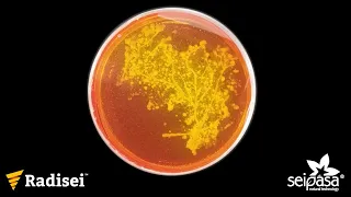 Acción del Bacillus subtilis en la colonización del entorno radicular | Radisei