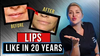 How to restore youth to lips? SECRET OF BEAUTIFUL LIPS