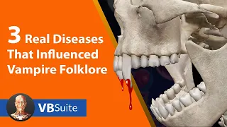 3 Real Diseases That Influenced Vampire Folklore | Visible Body