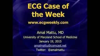 Amal Mattu’s ECG Case of the Week Jan 19,2015