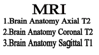 How to read MRI of Brain Anatomy