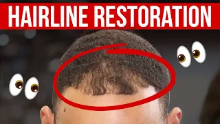 COULD YOU SAVE THIS HAIRLINE?!?