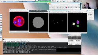 I2K 2020 tutorial: 3D Analysis with the 3D ImageJ Suite (session 2, part 1)