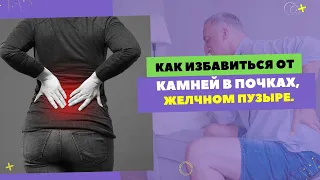 КАК ИЗБАВИТЬСЯ ОТ КАМНЕЙ В ЖЕЛЧНОМ ПУЗЫРЕ. ✅ Отзыв пациента. [Шишова О.И.]