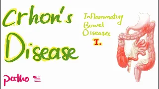 Crohn's Disease (IBD)🩸| illustrated explanation of Morphological basis 📚🔥