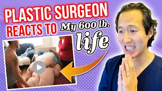 Plastic Surgeon Reacts to MY 600 LB LIFE: Will She Survive Massive Weight Loss? Massive lymphedema