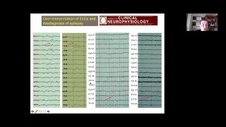 ILAE Eastern Mediterranean 27 October Webinar 2020 10 27