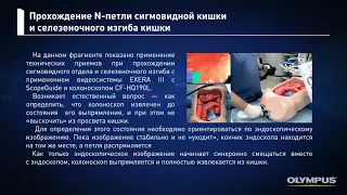 Колоноскопия- техника выполнения (учебное пособие)