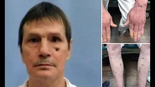 Court refuses to stop execution of inmate with 'bad veins'