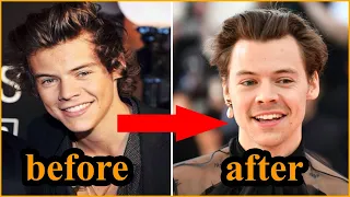 Harry Styles | Transformation From 1 To 26 Years Old