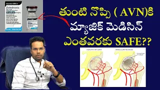 తుంటి నొప్పి(AVN)కి మెడిసిన్ సైడ్ ఎఫెక్ట్స్ | Bisphosphonate for AVN | Side effects | Dr Ramprasad K