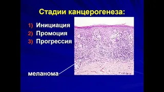 Опухоли на рус языке Патофизиология