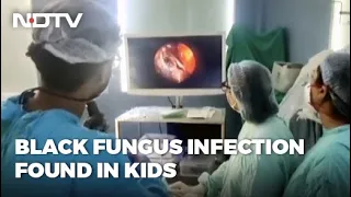 Covid-19 News: Eyes Of 3 Children Infected With Black Fungus Removed In Mumbai