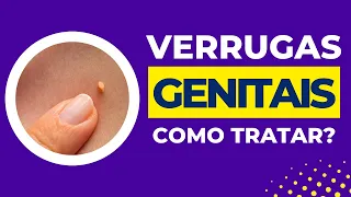 Como tratar verrugas genitais?