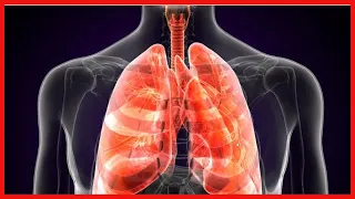 Was ist die Lungenpest und was sind ihre Symptome?