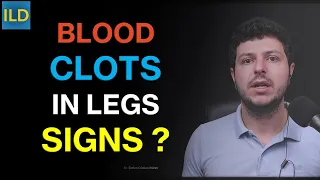 Blood clots in the legs - recognize the signs and risk