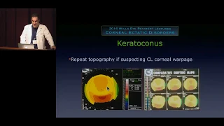 Corneal Ectatic Disorders