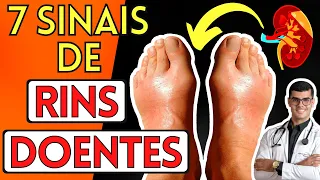 7 SINTOMAS de que seus RINS Podem Estar DOENTES (Sinais de Insuficiência Renal)