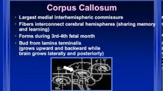 Нейросонография - Анатомия (с переводом на русский) - Sonography Of The Infant Brain Anatomy