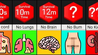Comparison: Can You Survive Without Organs?"