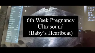 6 WEEKS ULTRASOUND | PREGNANCY JOURNEY | BABY'S HEARTBEAT