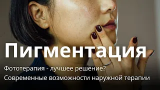 ВЕБИНАР: Пигментация. Фототерапия - лучшее решение? Современные возможности наружной терапии.