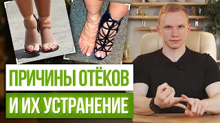 Почему появляются отёки? / Как быстро убрать опухлость лица и снять очень сильные отеки?