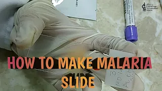 How to make malaria slides?2 ways to make malaria slides.