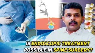 Is Endoscopic Treatment Possible in Spine Surgery? Dr. Vignesh Pushparaj