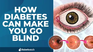 How Diabetes Can Make You Go Blind