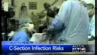 C-section infection risks