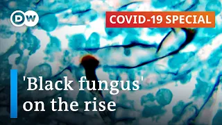 India sees rise in rare 'black fungus' infections | COVID-19 Special