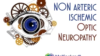 Non Arteritic and Arteritic Ischemic Optic Neuropathy