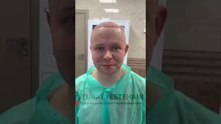 операция по пересадке волос 🇷🇺🇹🇷  #moscow Москве +7 909 95 777 01😊