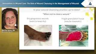 Webinar: Innovations in Wound Care