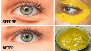 Turmeric Eye Mask & Got Rid of DARK CIRCLES in 5 Days | Remove Eye Wrinkles & Under Eye Bags